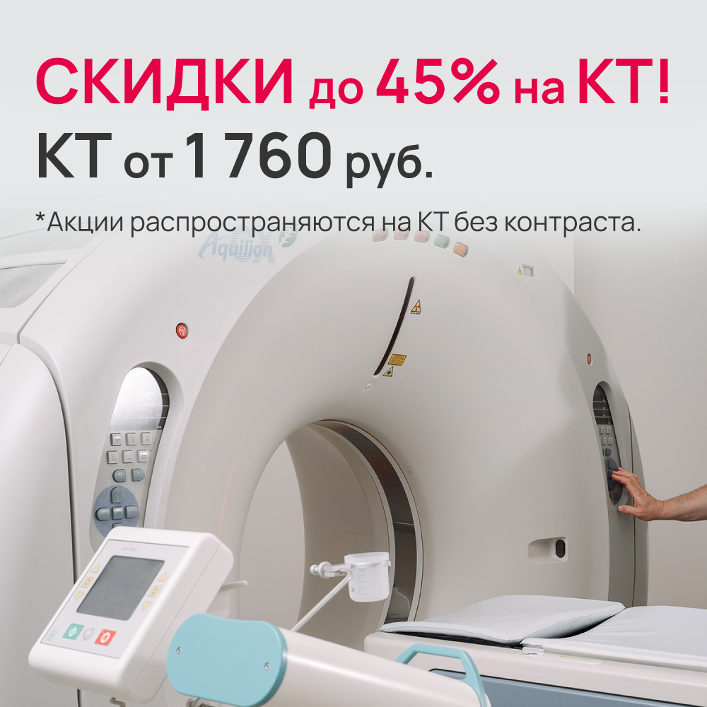Компьютерная томография (КТ)