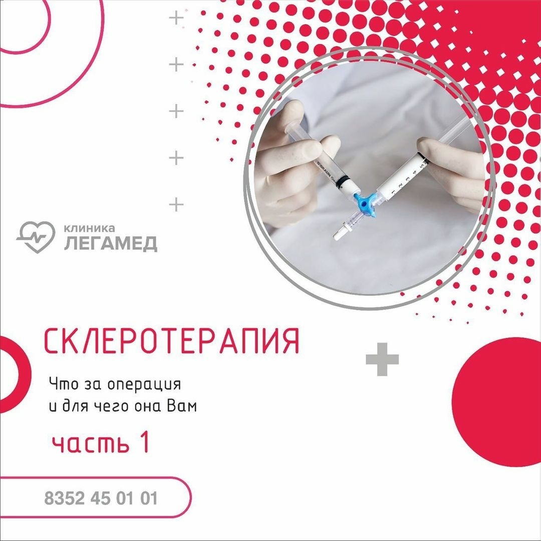 Склеротерапия
