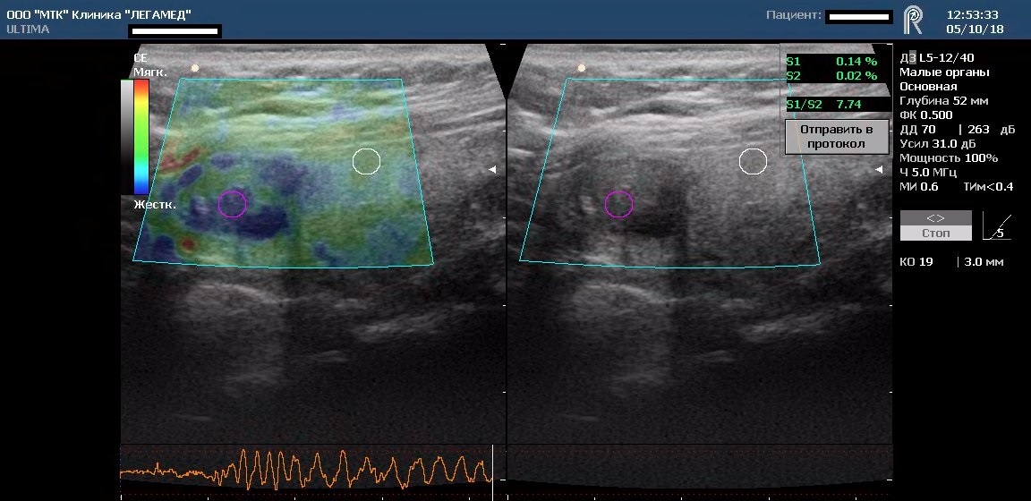 Соноэластометрия клиника Легамед