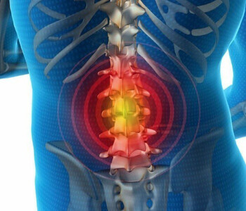 Межпозвонковые грыжи