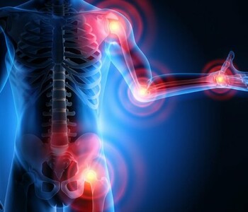 Артроз, артрит, бурсит